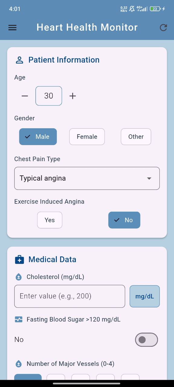 Heart rate monitoring