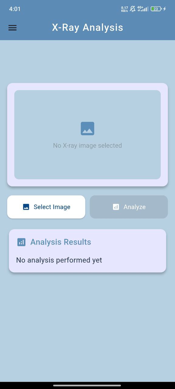 X-ray analysis